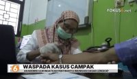 Universitas Lambung Mangkurat meminta pemerintah daerah di Kalsel bergerak cepat menghadapi penyebaran campak.